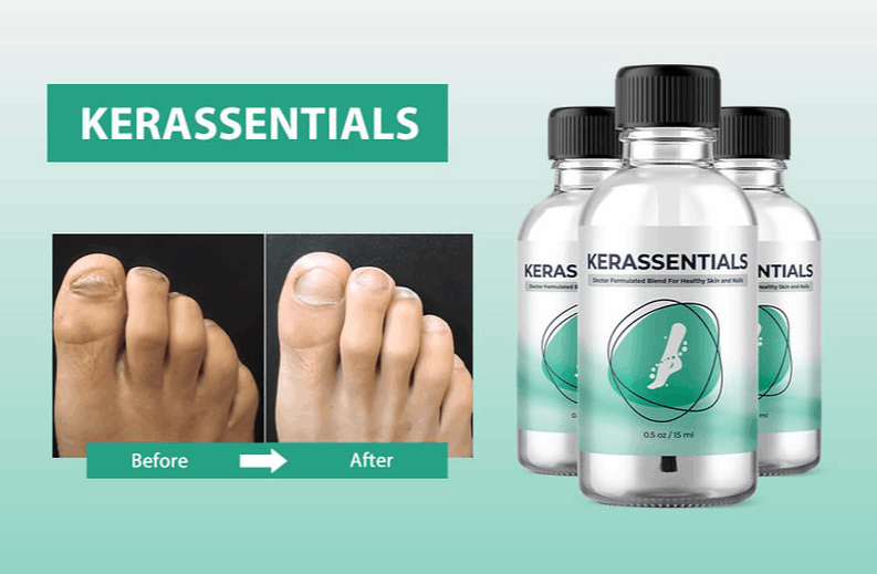 Kerassentials